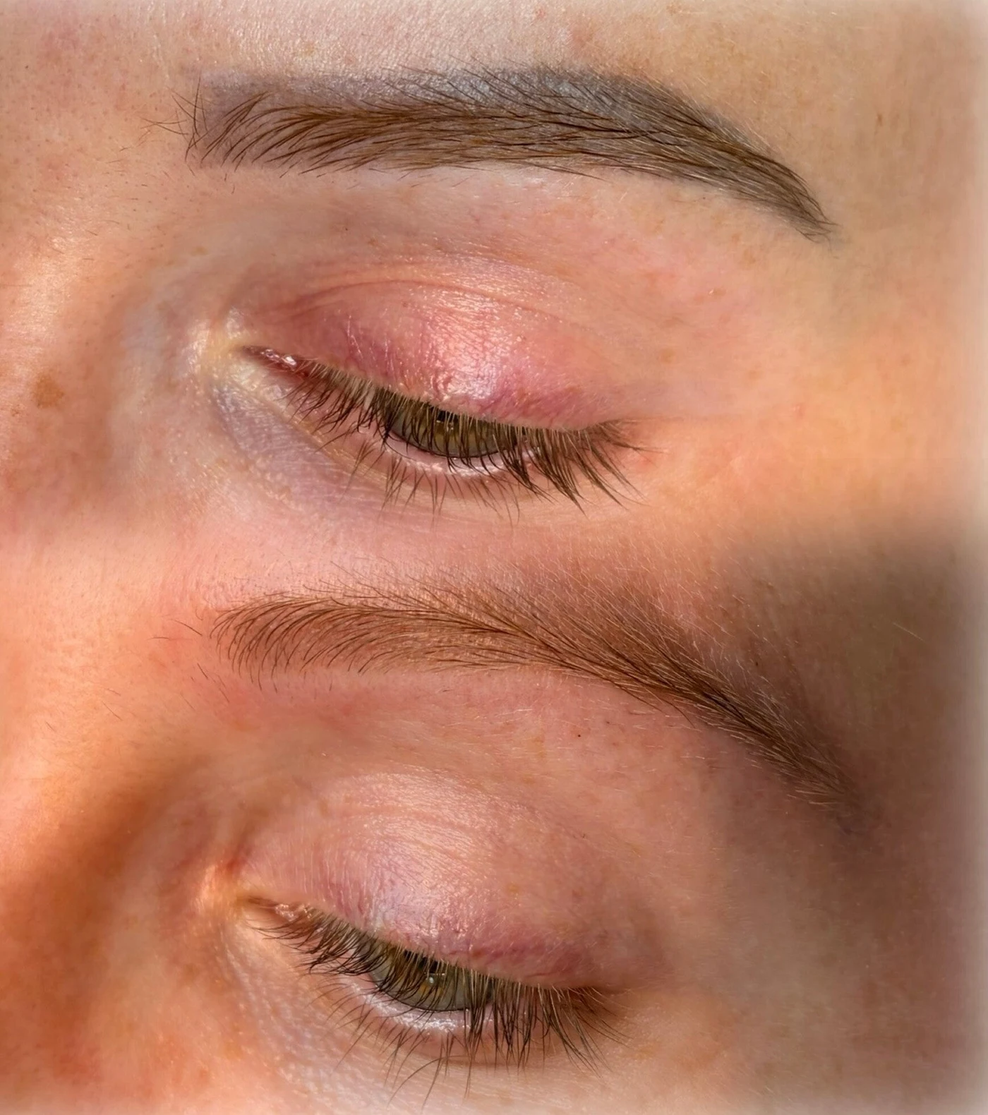 Laserbehandeling PMU wenkbrauwen bij By Shay